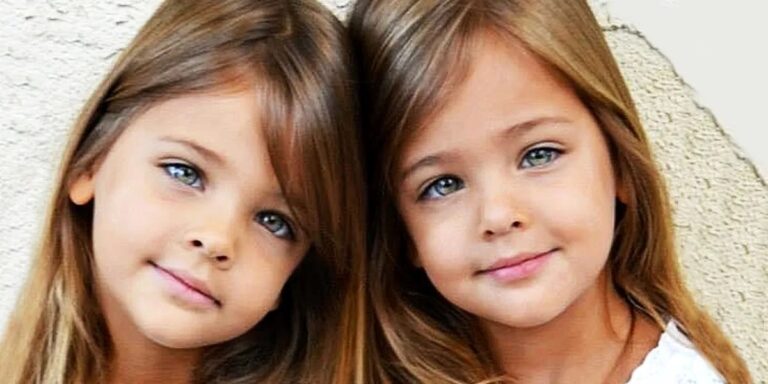 Identical Sisters Born in 2010 Grew Up to Become ‘Most Beautiful Twins in the World’ — How the Girls Look Now