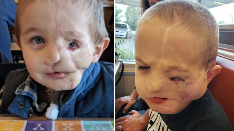 Boy, 5, survives savage attack by two dogs only to be called a ‘monster’ in public