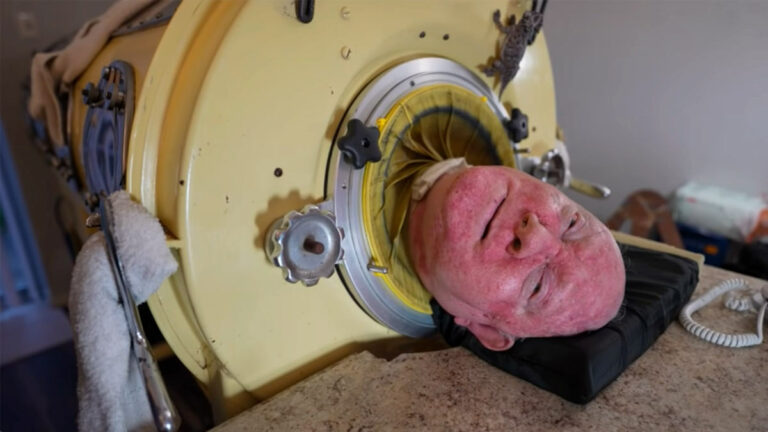 76-year-old man, paralyzed from polio at 6, was one of the last people with an iron lung: ‘My life is incredible’
