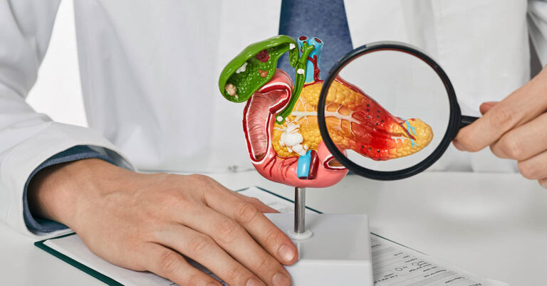 10 Signs of Pancreatic Cancer You Should Never Ignore