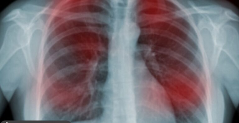 20 Early Signs Your Body is Fighting Cancer
