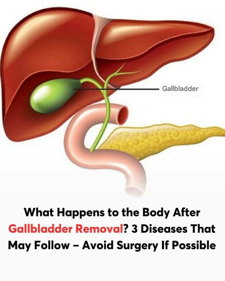 What to Expect After Gallbladder Surgery: Side Effects and Dietary Tips