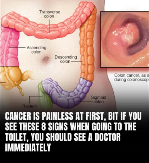 40+ Weird Signs That Lead To a Cancer Diagnosis