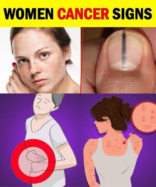 10 Cancer Warning Signs Women Often Overlook
