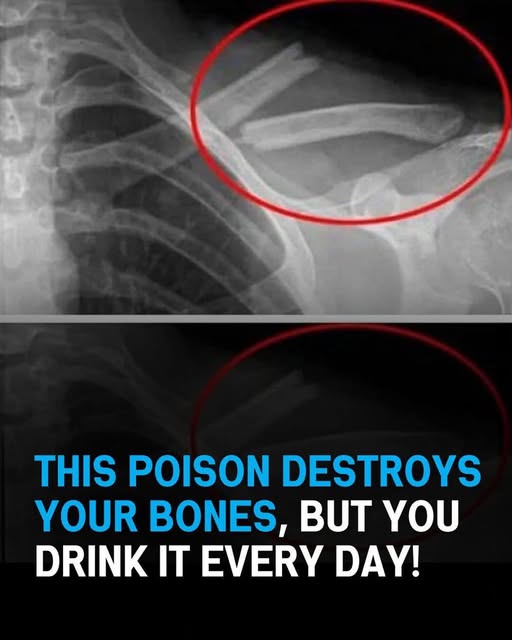 8 Detrimental Effects Soda Can Have On Your Body